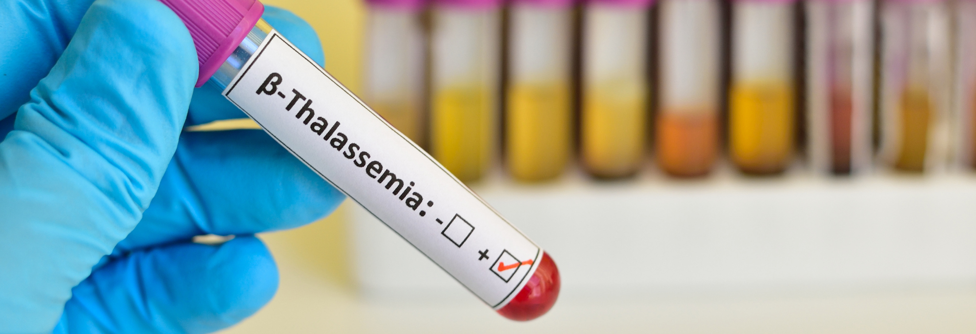 2000x685 for website.png