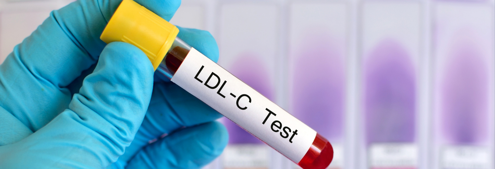 2000x685 for website.png